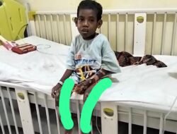 Kelvin Sumatan, Bocah 9 Tahun Penderita Gizi Buruk Hingga Lumpuh