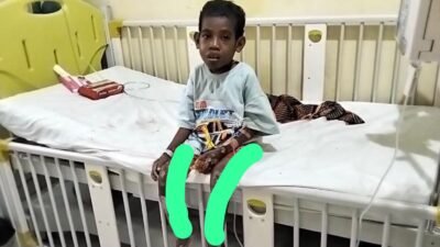 Kelvin Sumatan, Bocah 9 Tahun Penderita Gizi Buruk Hingga Lumpuh