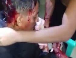 Teror Buaya di Laut Tanimbar! Warga Watmuri Selamat dari Maut, Alami Luka Parah